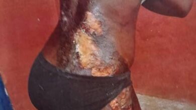 Photo of Trader pours hot water on daughter for taking her GH¢5.00 for food