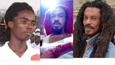 Photo of Achimota School Rastafarian student allegedly stabs father’s hand