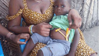Photo of Two-year-old boy needs financial support to undergo surgery