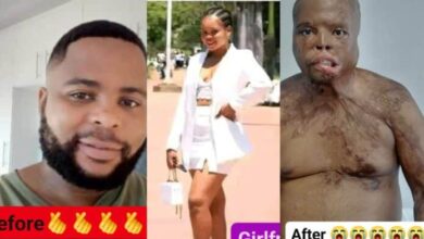 Photo of Sad! Lady pours acid on her boyfriend for allegedly cheating on her